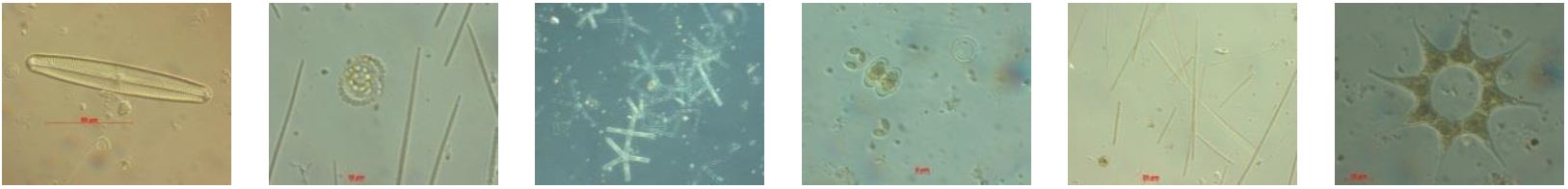Die 6 Fotos zeigen verschiedene Formen frei im Wasser schwebender, unter dem Mikroskop erkennbarer Algen (mit Stäbchenform, nadel- und sternförmig).